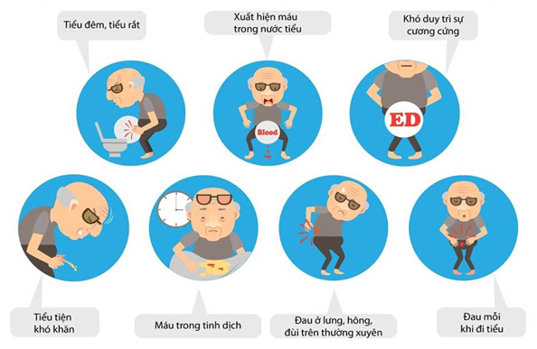 Dấu hiệu phát hiện sớm ung thư tuyến tiền liệt